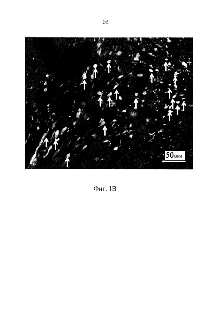 Новый способ лечения инфаркта миокарда с применением фрагмента hmgb1 (патент 2647467)