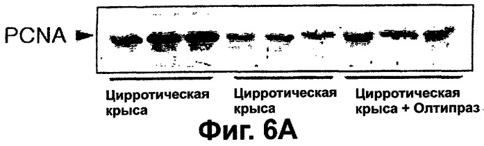 Фармацевтическая композиция для регенерации цирротической печени (патент 2291696)