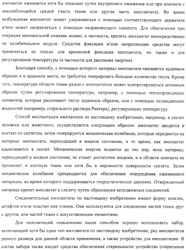 Имплантаты для создания соединений с тканями, в частности со скелетом, а также устройство и способ имплантации (патент 2314768)