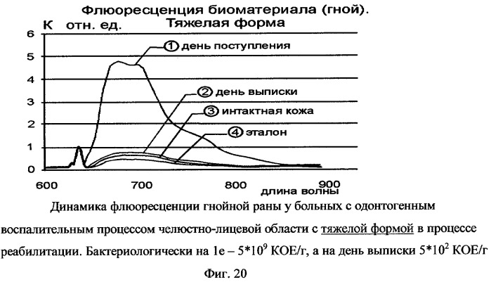 Способ люминесцентной диагностики и/или качественной оценки состояния биологического объекта и устройство для его осуществления (патент 2254372)