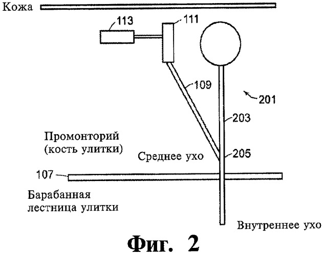 Имплантируемое устройство и способ доставки текучего лекарственного препарата в ткань (патент 2423154)