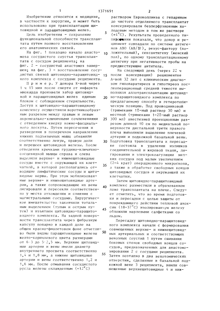 Способ трансплантации щитовидно-паращитовидного комплекса (патент 1371691)