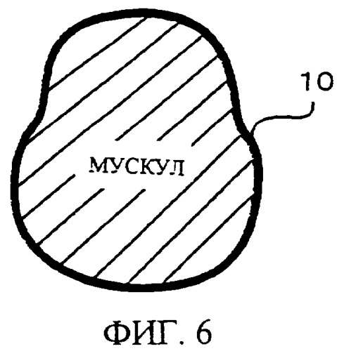 Устройство для укрепления мускулов (патент 2350371)
