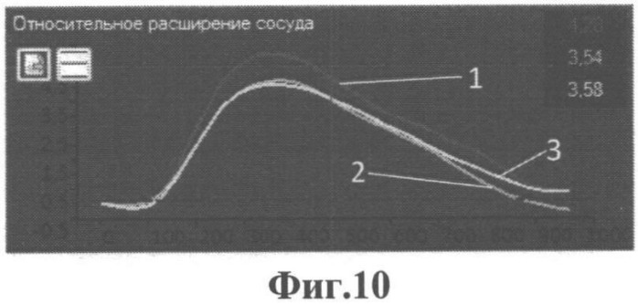 Способ определения подвижности атеросклеротической бляшки (патент 2536785)