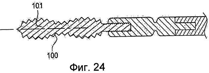 Металлический аппликатор (патент 2458612)