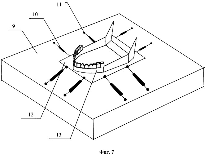 Способ измерения параметров объемной поверхности нижней челюсти человека (патент 2284750)