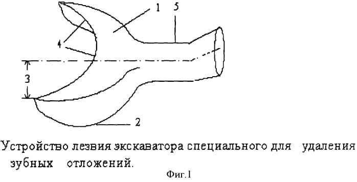 Экскаватор для удаления зубных отложений (патент 2353328)