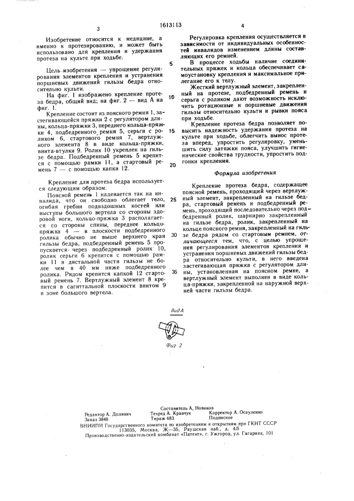 Крепление протеза бедра (патент 1613113)