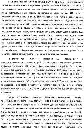 Способ лечения путем подкожной подачи пониженного давления с использованием разделения с помощью воздушного баллона (патент 2405588)