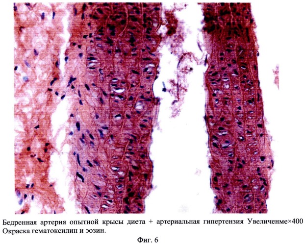 Способ моделирования атеросклероза (патент 2500041)