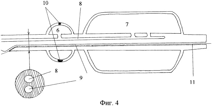 Двухбалонная система доставки усеченного стента (патент 2491038)