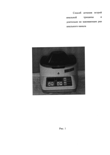 Способ лечения острой анальной трещины и длительно незаживающих ран анального канала (патент 2578853)