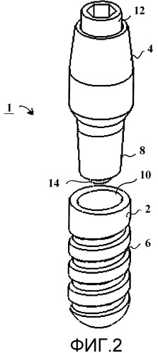 Дентальный имплантат (патент 2485910)