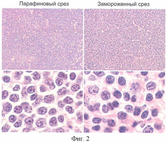 Способ изготовления срезов из свежезамороженной ткани лимфатических узлов (патент 2432575)