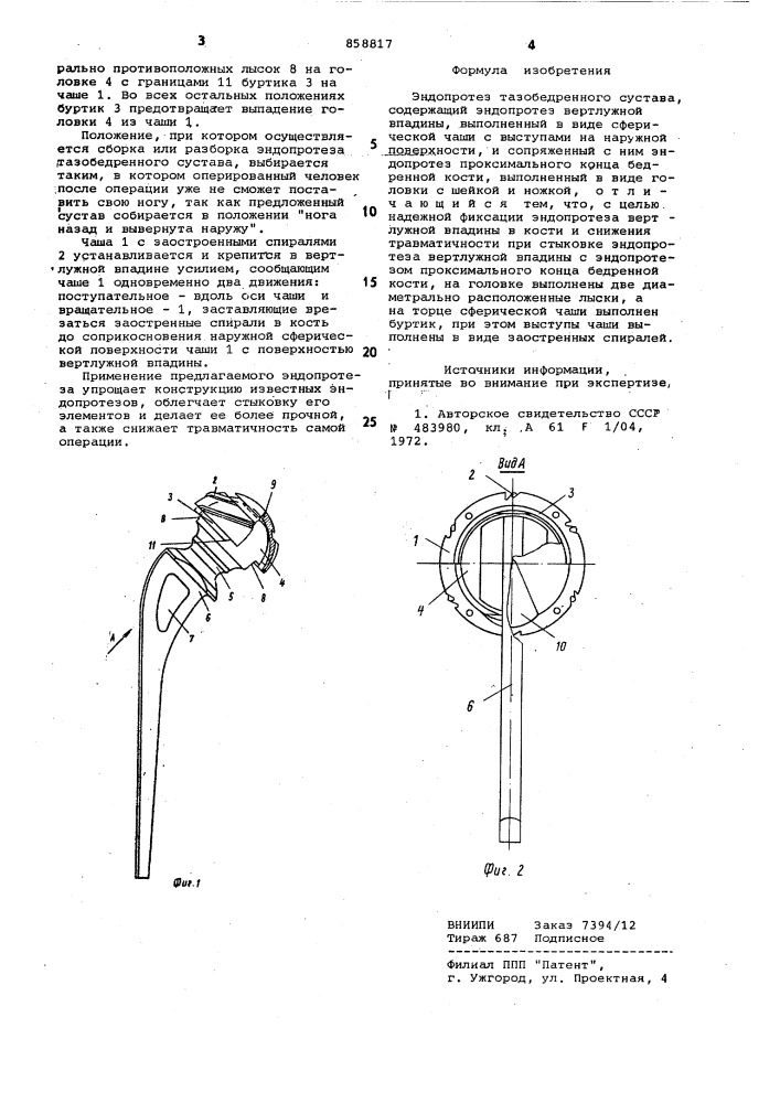 Эндопротез тазобедренного сустава (патент 858817)