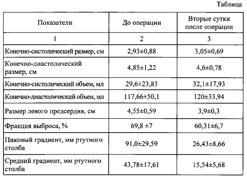 Фиброз клапанов