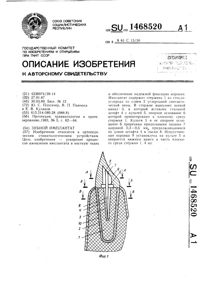 Зубной имплантат (патент 1468520)