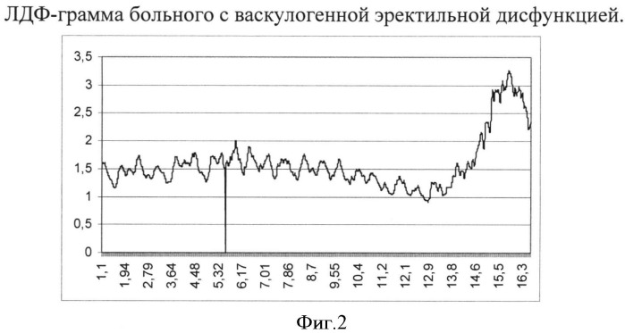 Способ диагностики васкулогенной эректильной дисфункции (патент 2511078)