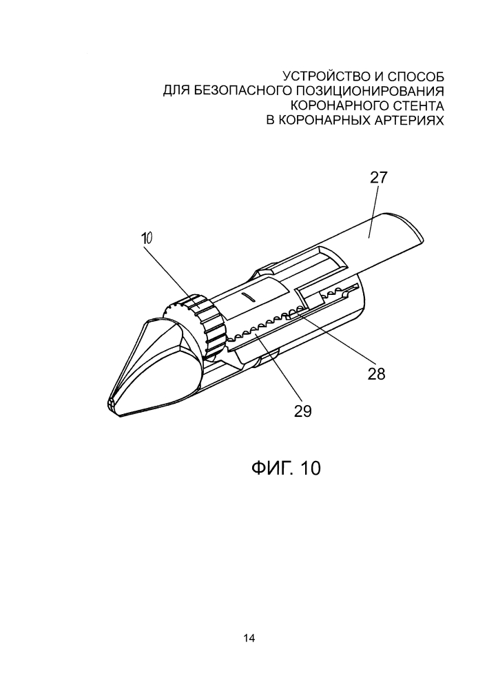 Устройство и способ для безопасного позиционирования коронарного стента в коронарных артериях (патент 2598798)