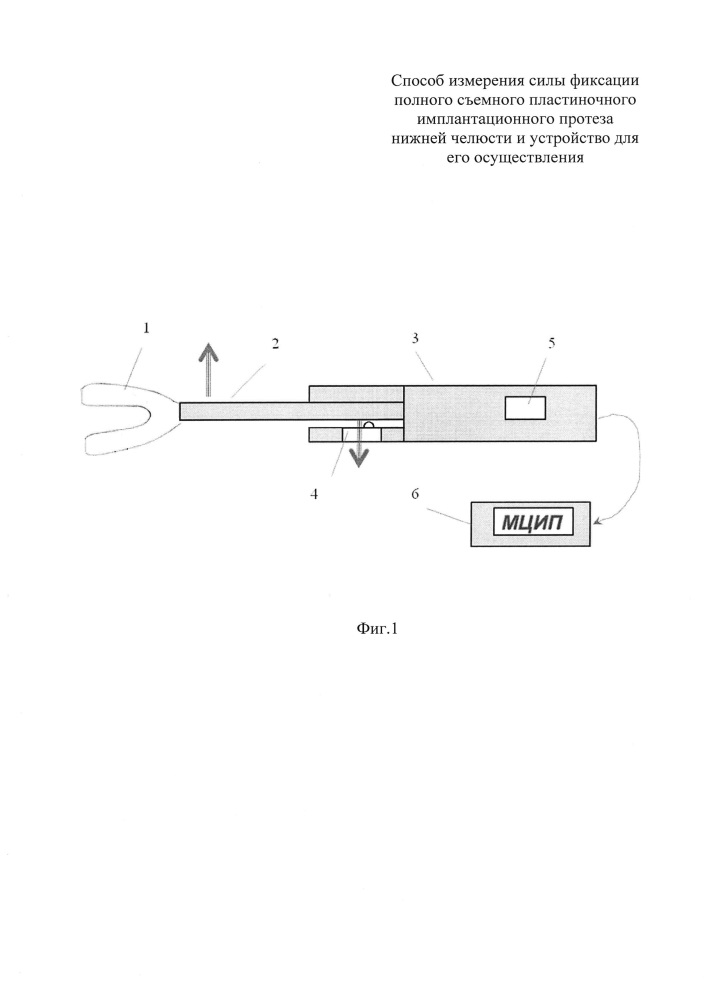 Способ измерения силы фиксации полного съёмного пластиночного имплантационного протеза нижней челюсти и устройство для его осуществления (патент 2640375)