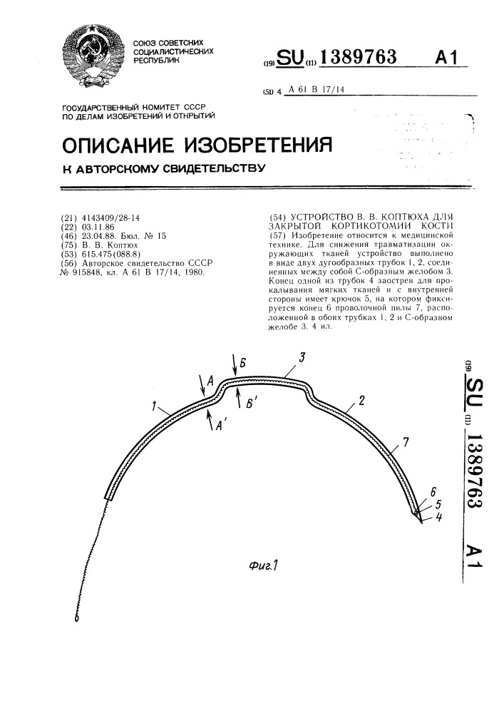 Устройство в.в.коптюха для закрытой кортикотомии кости (патент 1389763)