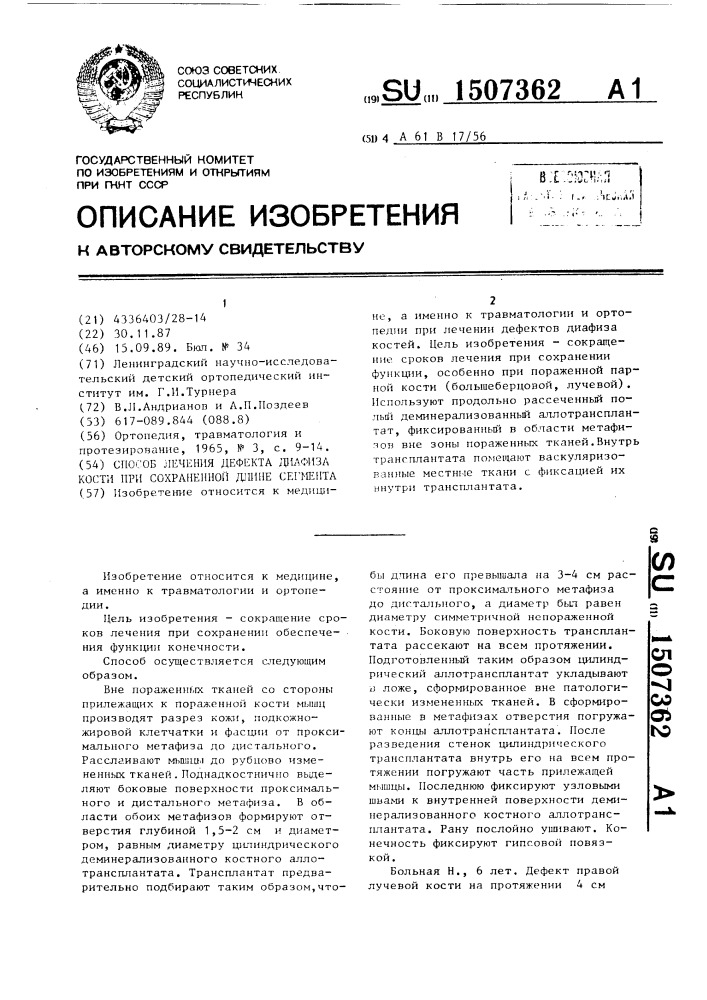 Способ лечения дефекта диафиза кости при сохраненной длине сегмента (патент 1507362)