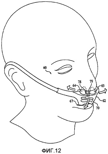 Назальный и оральный интерфейс пациента (патент 2447871)