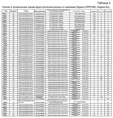 Фосфодиэстераза 9а в качестве маркера злокачественной опухоли предстательной железы (патент 2592668)