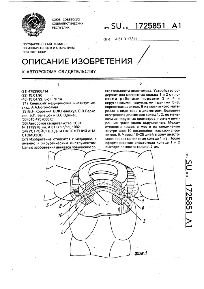 Устройство для наложения анастомозов (патент 1725851)