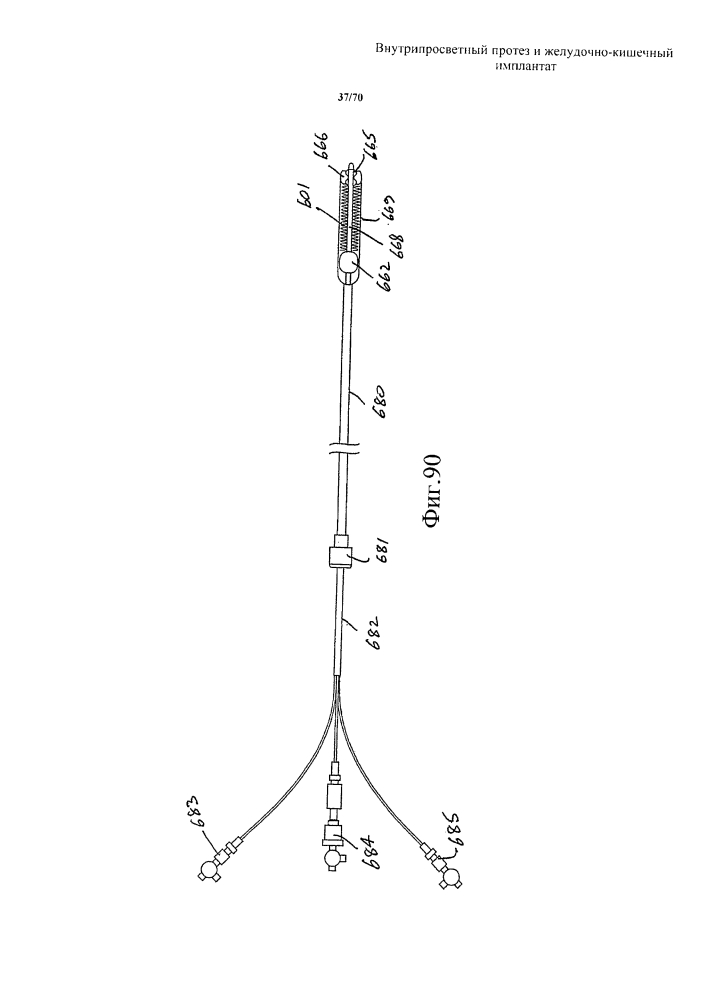 Внутрипросветный протез и желудочно-кишечный имплантат (патент 2626885)