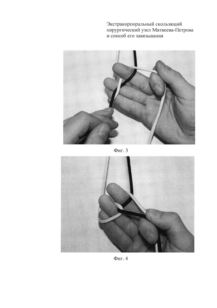 Экстракорпоральный скользящий хирургический узел матвеева-петрова и способ его завязывания (патент 2619751)