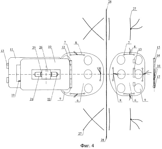 Комбинированный способ радикального хирургического лечения эпителиального копчикового хода (патент 2477085)