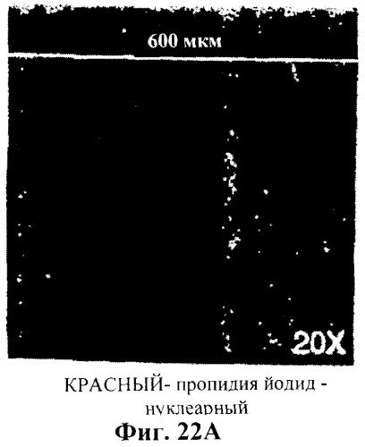 Захват эндотелиальных клеток-предшественников элюирующим лекарственные средства имплантируемым медицинским устройством (патент 2400256)