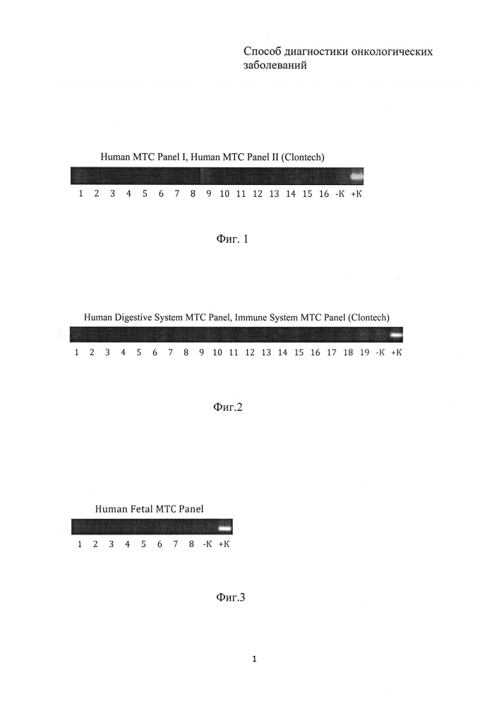 Способ диагностики онкологических заболеваний (патент 2642989)