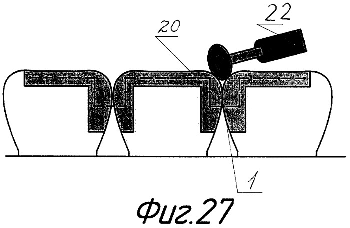 Способ шинирования зубов (варианты) и устройство для его осуществления (патент 2276971)