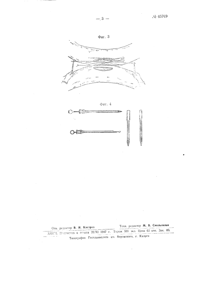 Способ наложения съемного шва, накладываемого на стенки желудка или кишки (патент 65769)