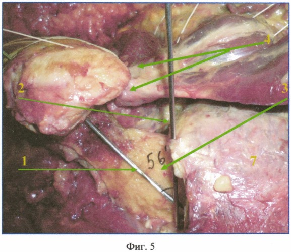 Способ анатомо-хирургического моделирования наружной ротационной контрактуры тазобедренного сустава в эксперименте (патент 2529407)