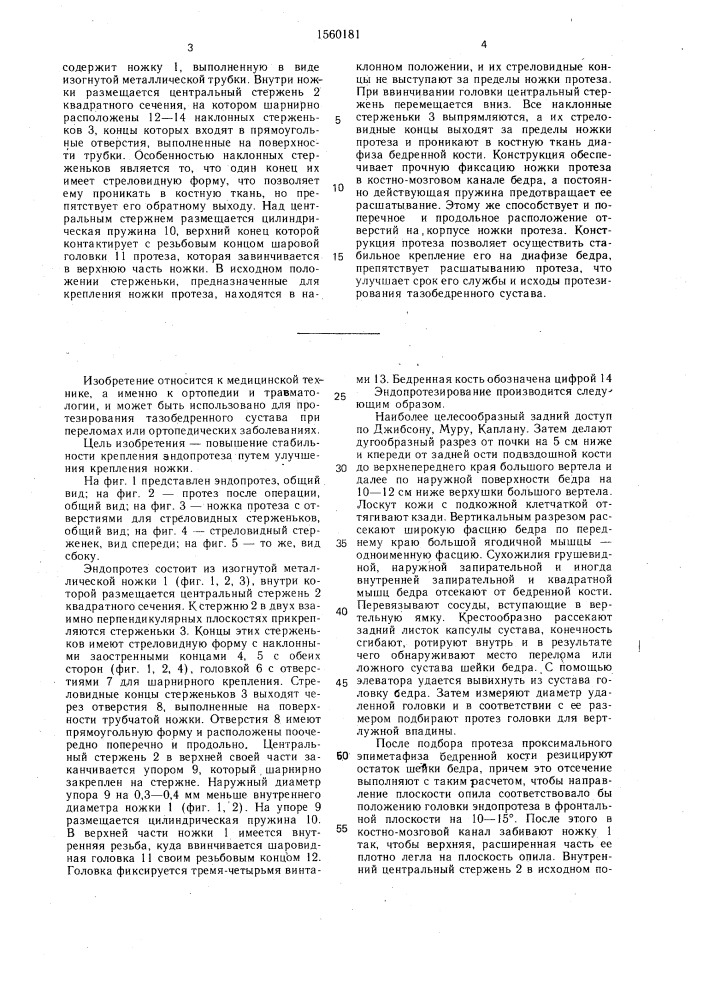 Эндопротез проксимального эпиметафиза бедренной кости (патент 1560181)