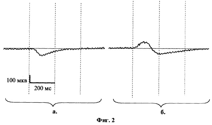 Способ определения траектории движений глаз при саккадических перемещениях взора (патент 2270598)