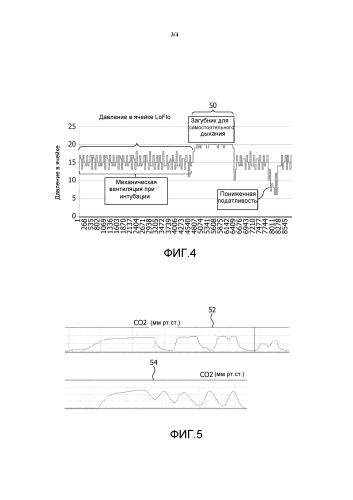 Система и способ контроля дыхания (патент 2580188)