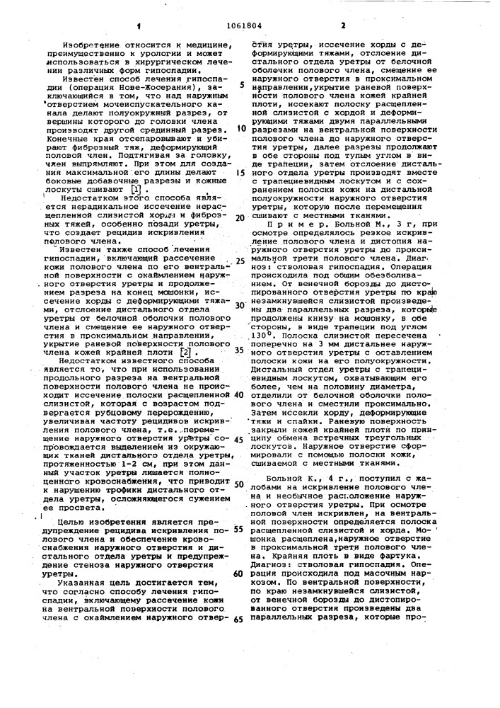 Способ лечения гипоспадии по русакову-кузнецову (патент 1061804)