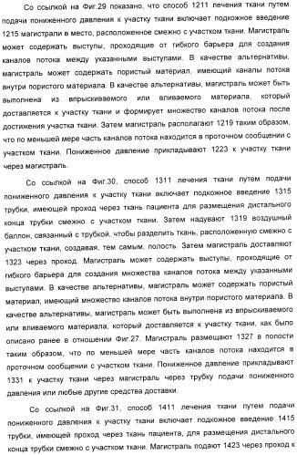 Система и способ продувки устройства пониженного давления во время лечения путем подачи пониженного давления (патент 2404822)