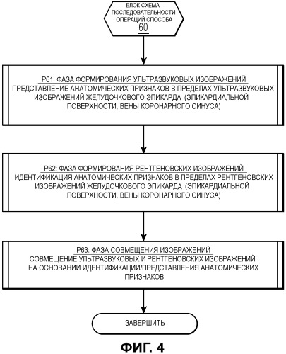 Система для комплексного слияния данных формирования изображения на основании статистических моделей анатомии (патент 2472442)