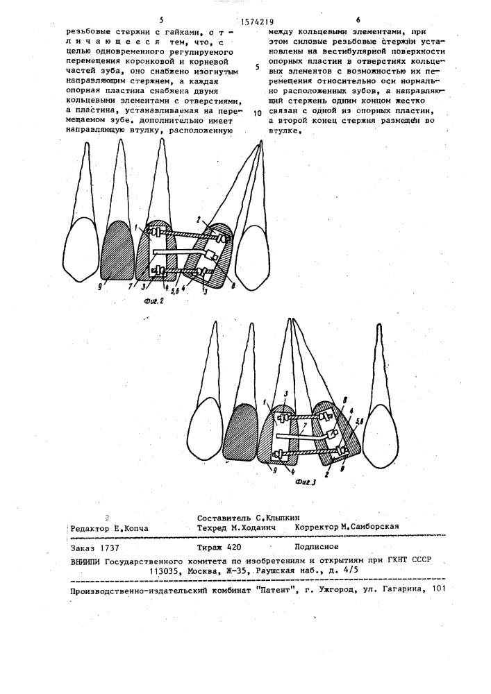 Ортодонтическое устройство (патент 1574219)