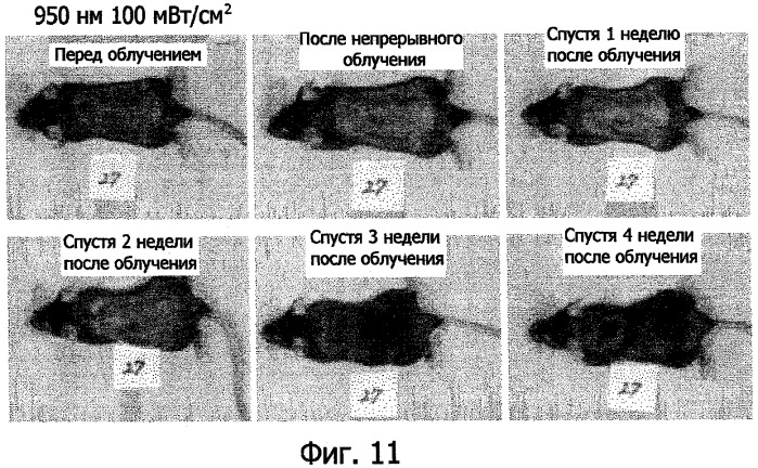 Способ стимуляции роста волос и устройство для осуществления этого способа (патент 2440835)