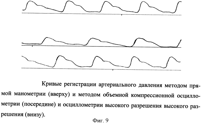 Способ определения артериального давления, параметров гемодинамики и состояния сосудистой стенки с использованием осциллометрии высокого разрешения (патент 2360596)