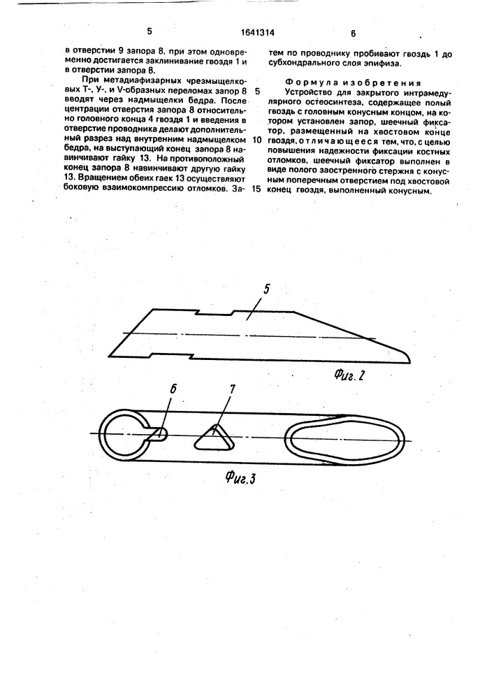 Устройство для закрытого интрамедулярного остеосинтеза (патент 1641314)