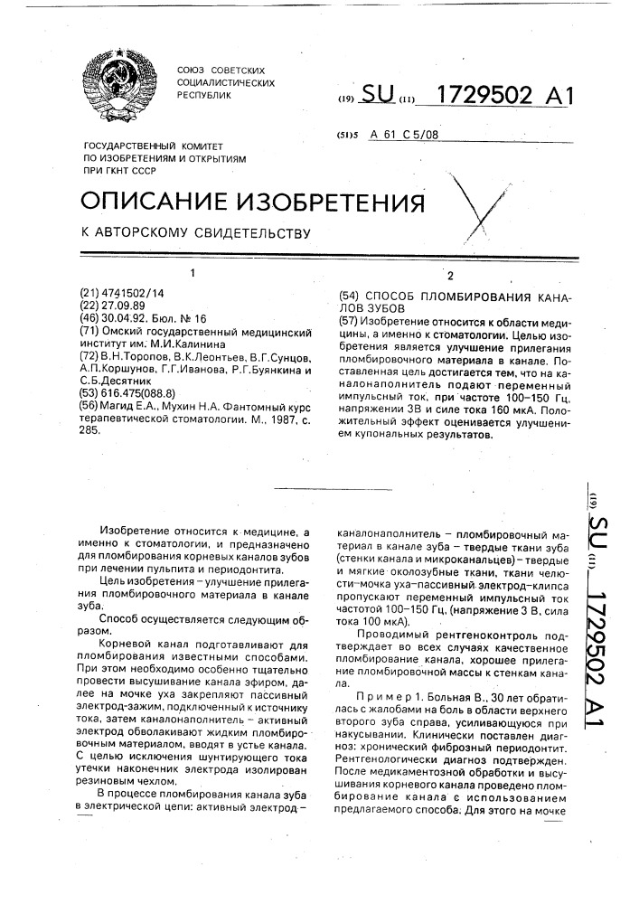 Способ пломбирования каналов зубов (патент 1729502)