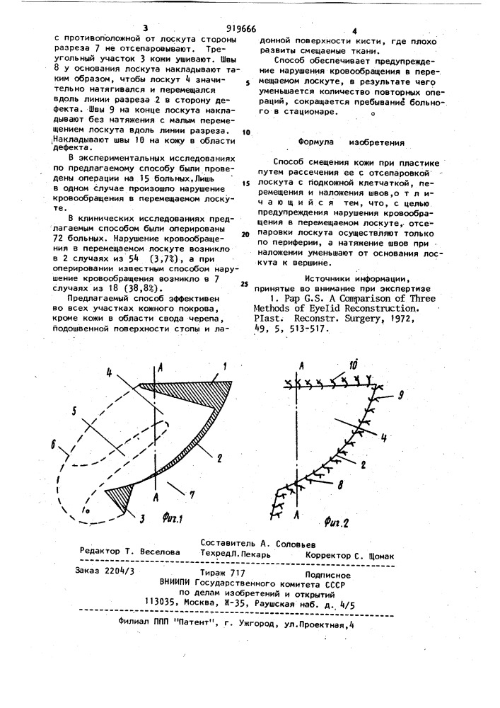 Способы смещения. Линии натяжения и смещения кожи.