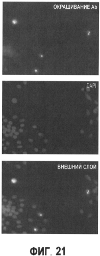 Вакцины на основе свиного вируса torque teno и способы диагностики инфекций, вызванных этим вирусом (патент 2553223)